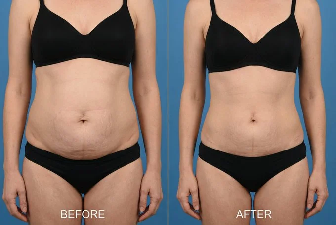 Portrait featuring Body Contouring - Minimalist via Nano Banana